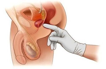 Masage prostata