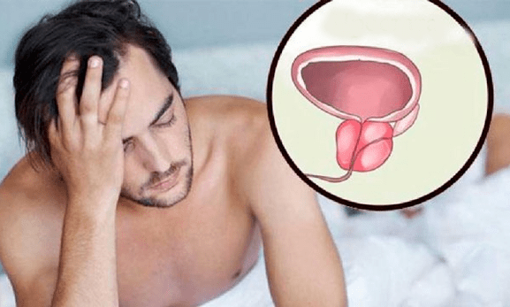 Symptômes de la prostatite